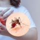 best mosquito treatment in delhi